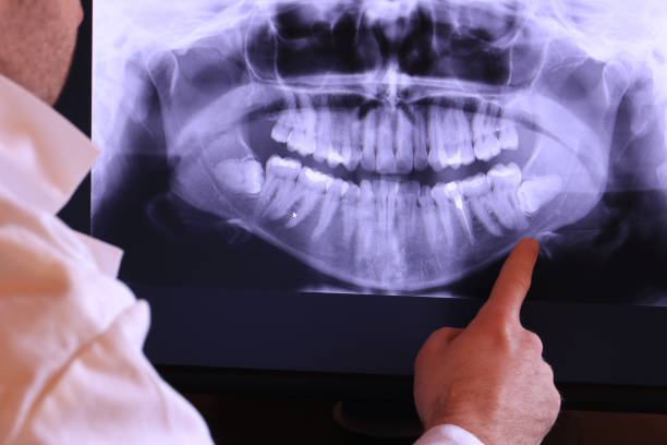 Best Emergency Gum Treatment in Annetta, TX